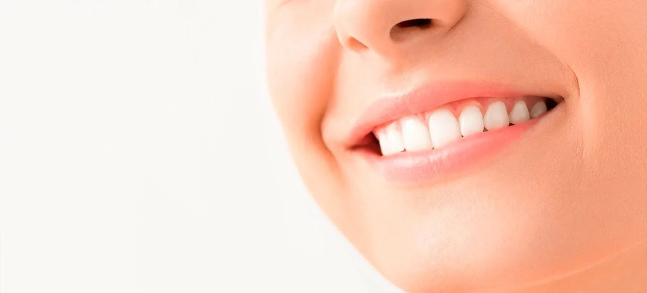 Clareamento Dental