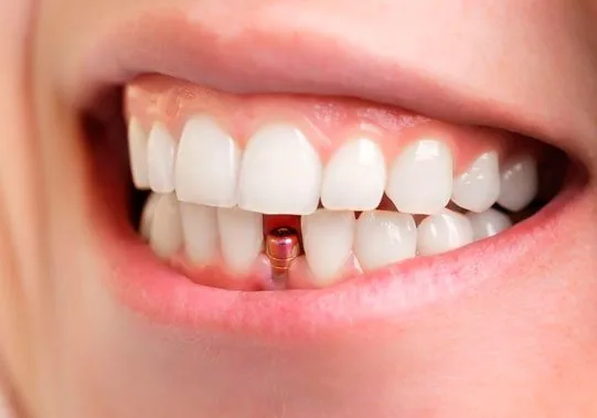 Dentística