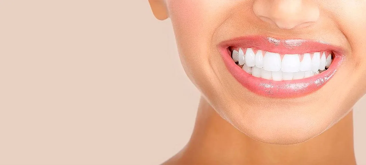 Lentes de Contato Dental